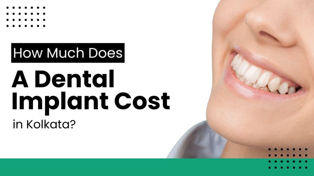 How Much Does a Dental Implant Cost in Kolkata? Find Out Here