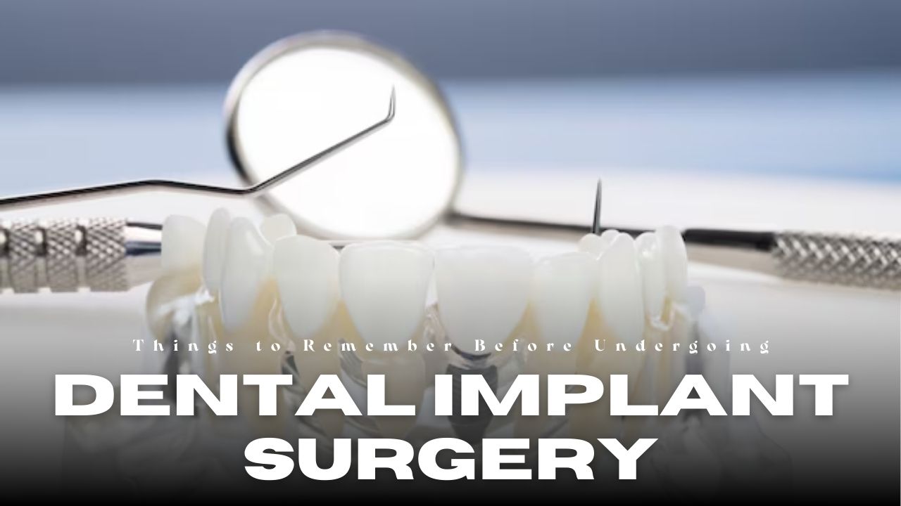 Top Things to Remember Before Undergoing Dental Implant Surgery in 2025